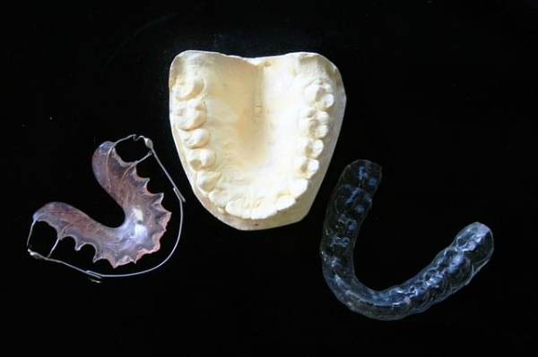 7-protesi-denti-dentiera.jpg